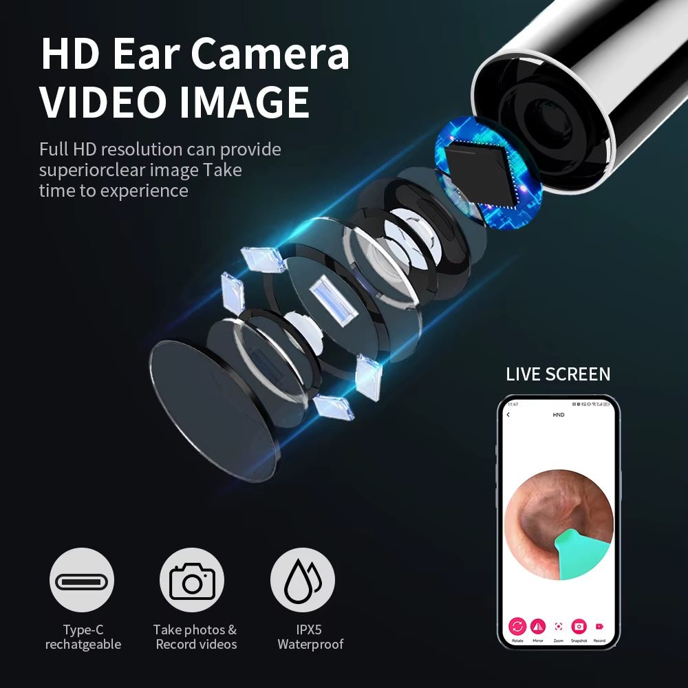 1 Hygi'ear Nettoyant d'Oreilles avec Caméra 360° – Sécurité, Innovation et Confort. - Tec'hygi